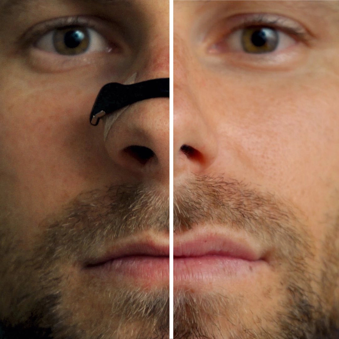 Inhale Flow™ Magnetic Nasal Bands
